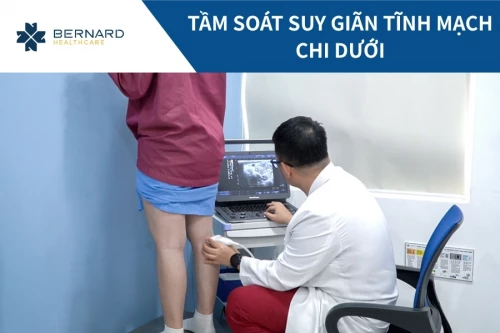 Tầm soát suy giãn tĩnh mạch chi dưới